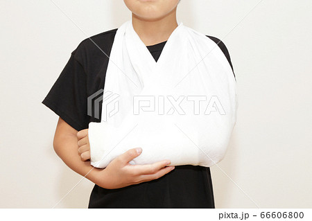 腕の骨折 ギプスの写真素材