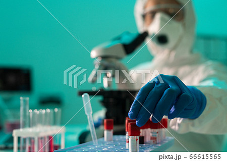 Examining blood of coronavirus patients 66615565