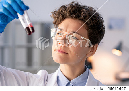 Comparing blood samples Comparing blood samples 66615607