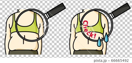 Obese woman back-close up Obese woman back-close up 66665492