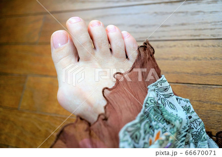 外反母趾 素足 外反母趾 素足 66670071