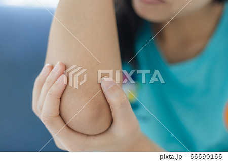 Woman suffering from chronic joint rheumatism. 66690166