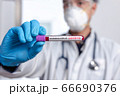 The doctor holds a test tube containing a blood sample 66690376