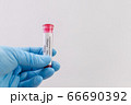 Hand holds a test tube containing a blood sample that has no the result positive or negative for coronavirus. 66690392