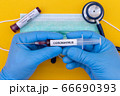 Hand holds a test tube containing a blood sample that has no the result positive or negative for coronavirus. 66690393