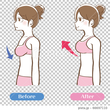 Bust-up before-after illustration Bust-up before-after illustration 66697110