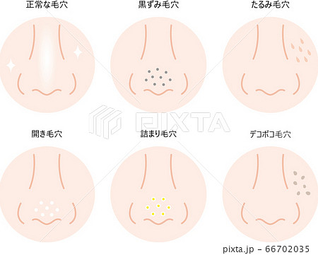 鼻の毛穴 セット 鼻の毛穴 セット 66702035