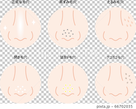 鼻孔定型 66702035