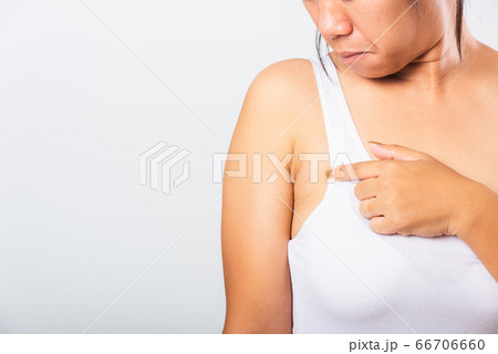Woman pointing her skin underarm she problem Woman pointing her skin underarm she problem 66706660