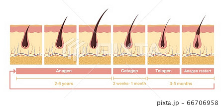Hair growth cycle illustration. Anatomical diagram of development hair follicles from anagen telagen. Hair growth cycle illustration. Anatomical diagram of development hair follicles from anagen telagen. 66706958