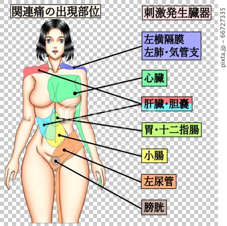 関連痛の出現部位 66727335