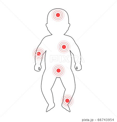 Pain in human body Pain in human body 66743954