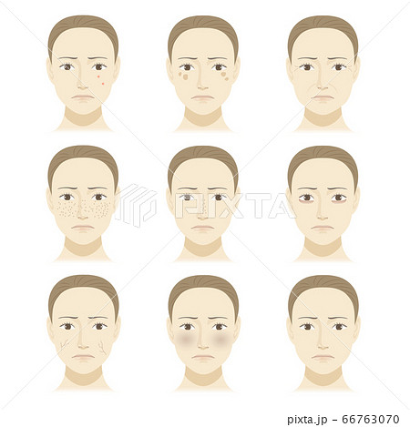 女性の顔 肌トラブル イラストセットのイラスト素材