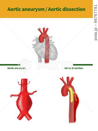 医学 心臓 血管のイラスト素材