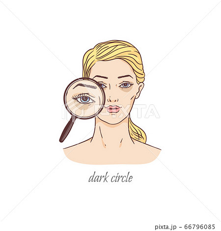 Dark under eye circle bag problem - blonde woman with magnifying glass Dark under eye circle bag problem - blonde woman with magnifying glass 66796085