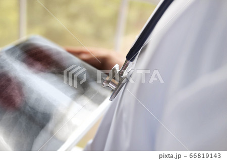 Doctor looking at lung x-ray, Pneumonia picture 66819143