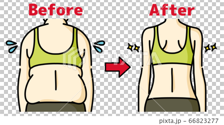 Overweight and slim female backs-before and after 66823277