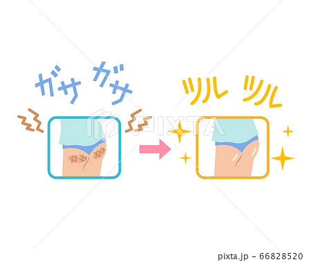 お尻の黒ずみや角質がツルツルになったイラストのイラスト素材 6685