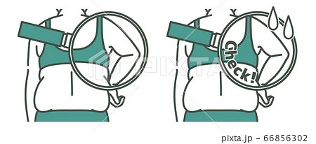 肥満の女性の二の腕と背中-クローズアップ-2色 66856302