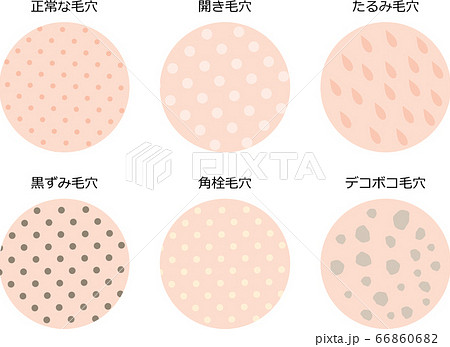 毛穴　肌表面　セット 66860682