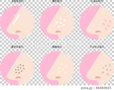 Nose pore symptoms set 66860685