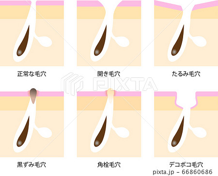 毛穴　肌の断面図　セット 66860686