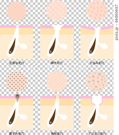 Pore skin surface and cross section set 66860687