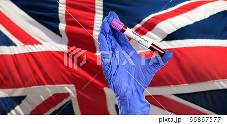 hand holding beaker with coronavirus blood test hand holding beaker with coronavirus blood test 66867577