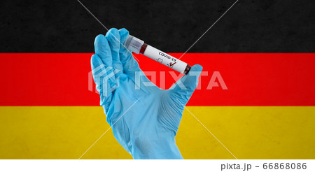 hand holding beaker with coronavirus blood test 66868086