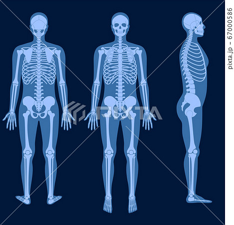 Skeleton x rayのイラスト素材 [67000586] - PIXTA