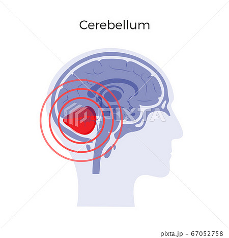 Pain Brain Illustration 67052758
