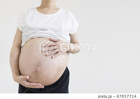 子宮筋腫でお腹が大きくなっている 妊娠37週目の女性の写真素材