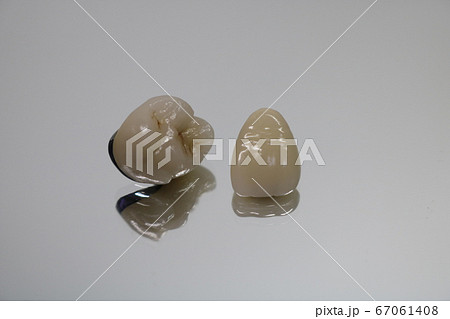 歯 歯 67061408