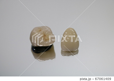 歯 歯 67061409