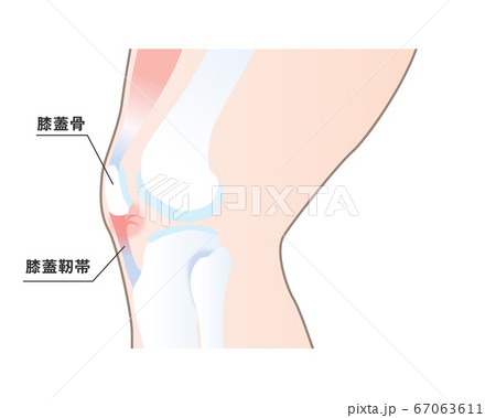 膝蓋靭帯が損傷したイラストのイラスト素材