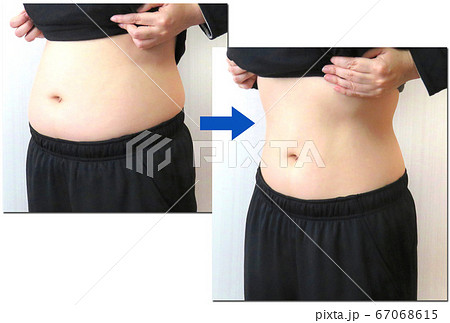 ダイエットビフォーアフター ダイエットビフォーアフター 67068615