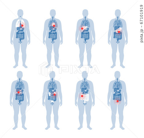 Pain in human body 67101919