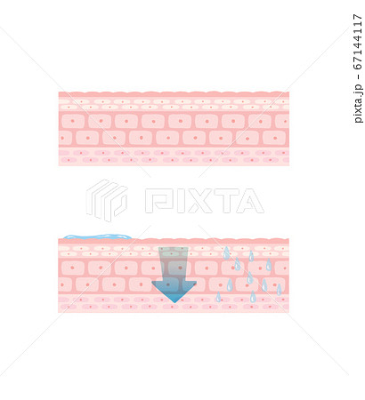 水分が浸透する肌図 67144117