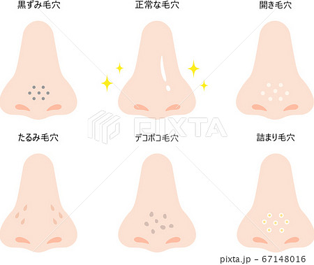 鼻の毛穴 セットのイラスト素材