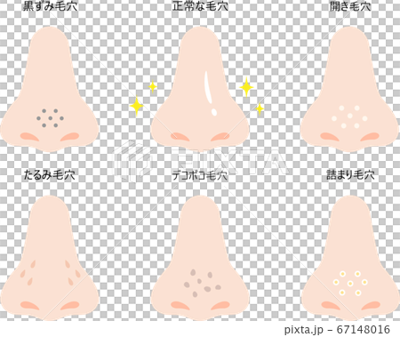 Nose pore set 67148016