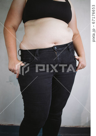 Overweight woman with obese body. Weight loss Overweight woman with obese body. Weight loss 67176653
