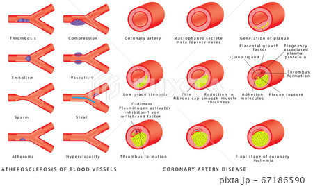 Blood vessels - arteries 67186590
