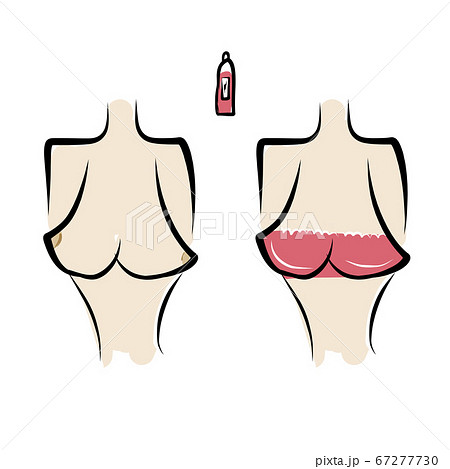Female breast sketch for your design - Stock Illustration [67277730] - PIXTA