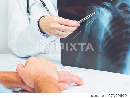 Female doctors hand pointing at x-ray medical 67309690