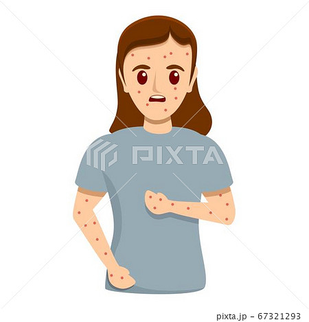 Girl measles infection icon, cartoon style Girl measles infection icon, cartoon style 67321293