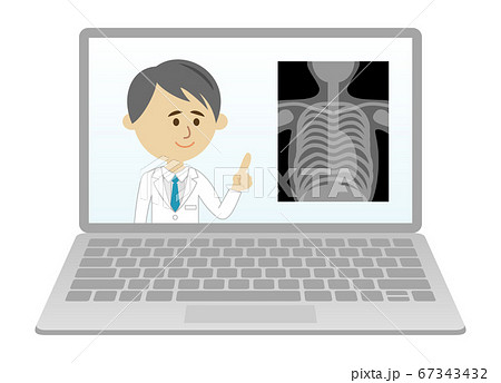 パソコンでオンライン診察のイラストイメージ 67343432