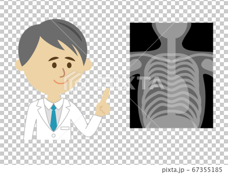 病院の先生とレントゲンのイラストイメージ 病院の先生とレントゲンのイラストイメージ 67355185