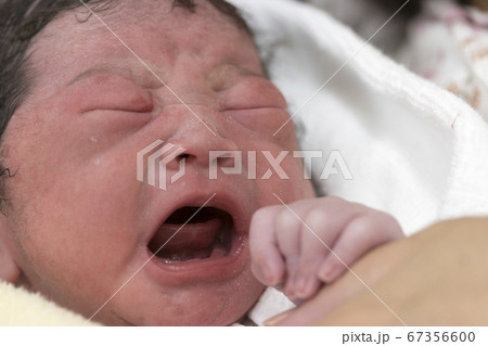 泣き声をあげている出産直後の新生児 泣き声をあげている出産直後の新生児 67356600
