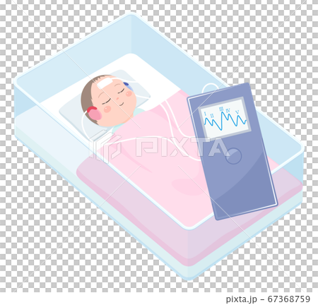 Illustration of newborn hearing screening _AABR 67368759