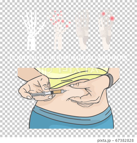 RHEUMATOID ARTHRITIS CONTROL Hypodermic Injection In Stomach Medical Human Illness Vector Illustration Set 67382828